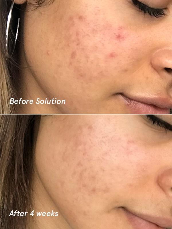 Glossier Solution Exfoliating Skin Perfector (5)