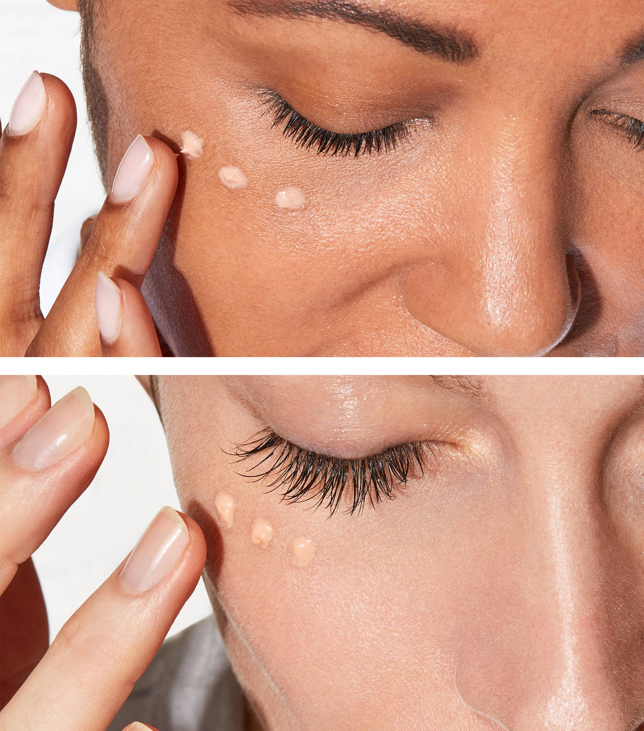 youth dose eye treatment