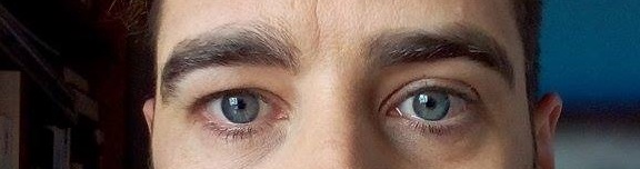 eyescut
