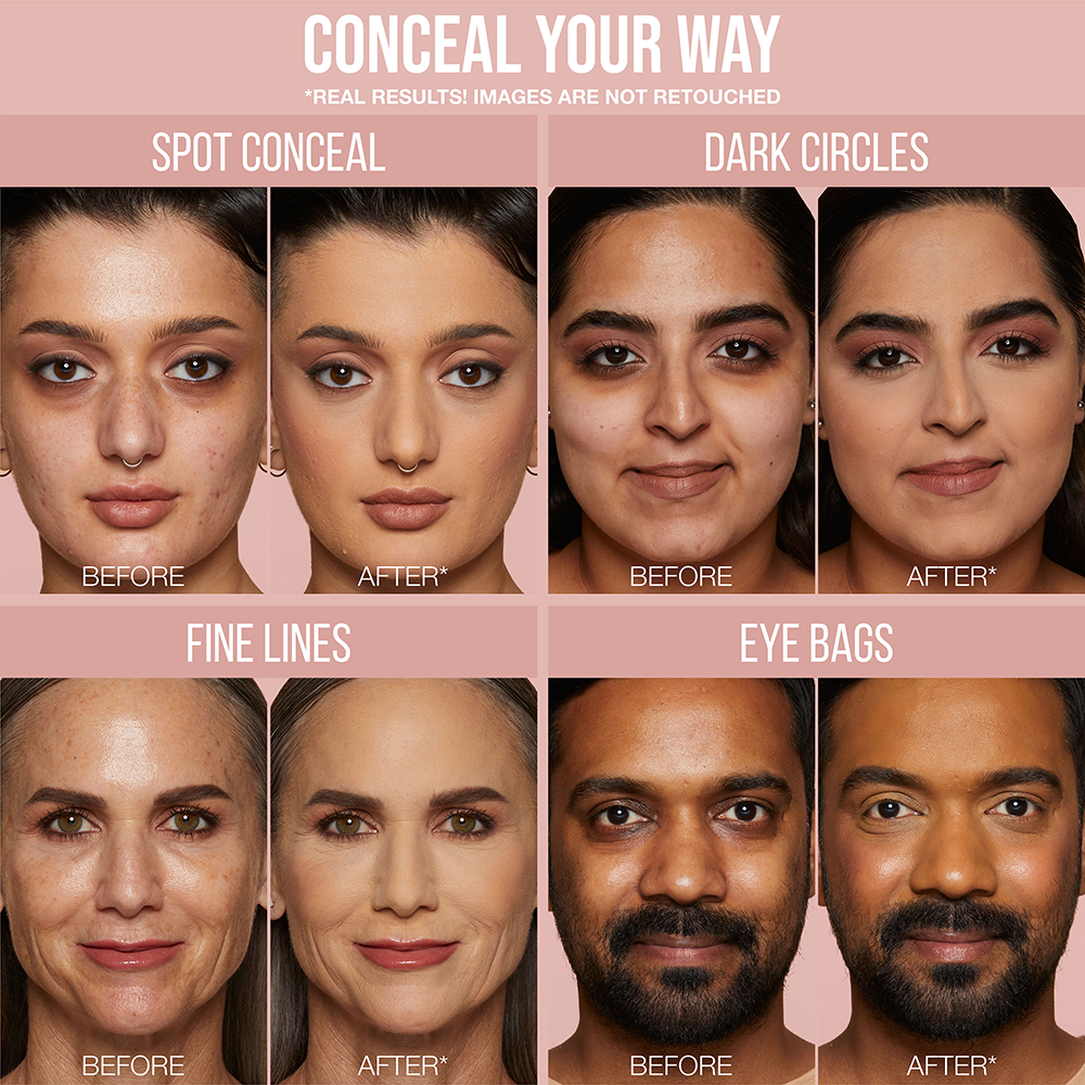 FF CONCEALER PDP SKIN CONCERNS-V2_SKIN CONCERNS FULL FACE 1